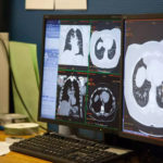 Ecran-scanner-radiologie-vendome